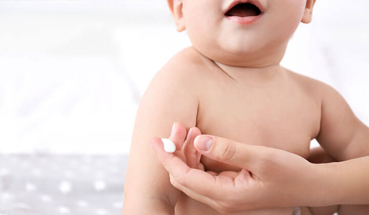 cuidado de la piel del bebé