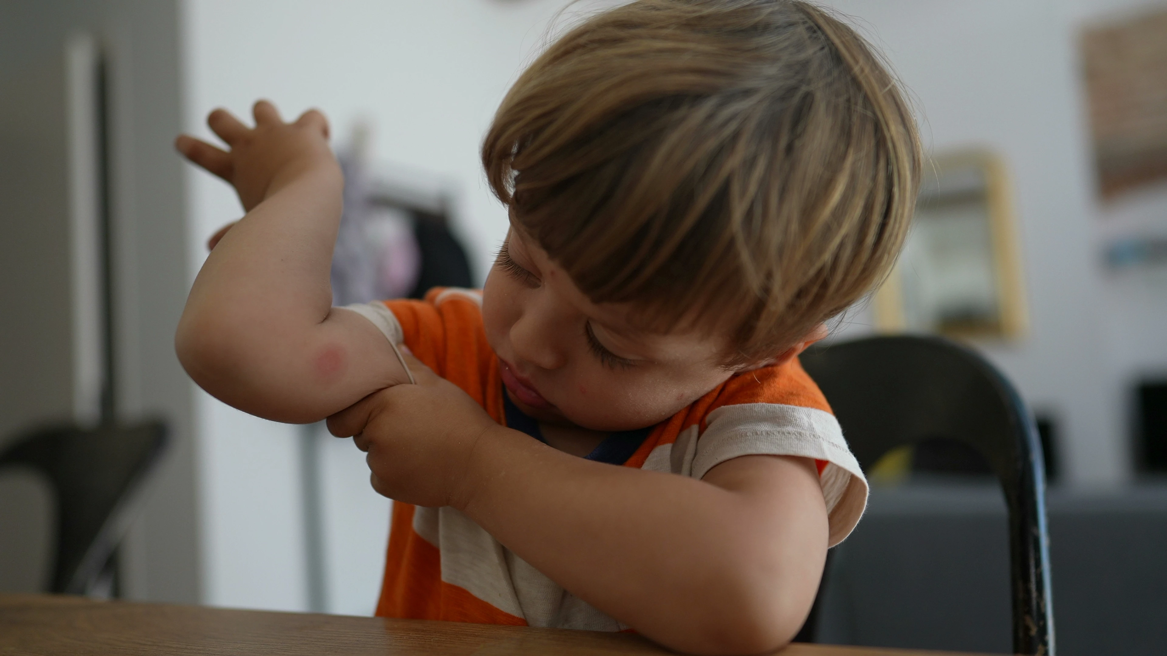 Picaduras de insectos en bebés