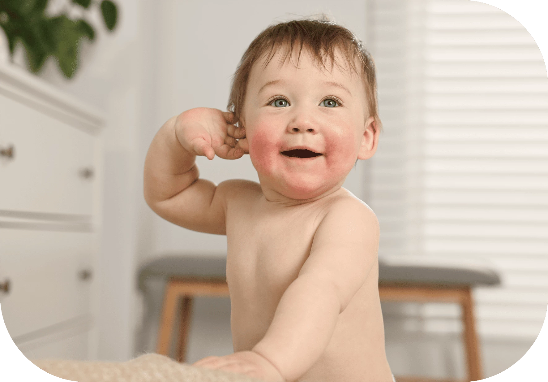 dermatitis alrededor de la boca